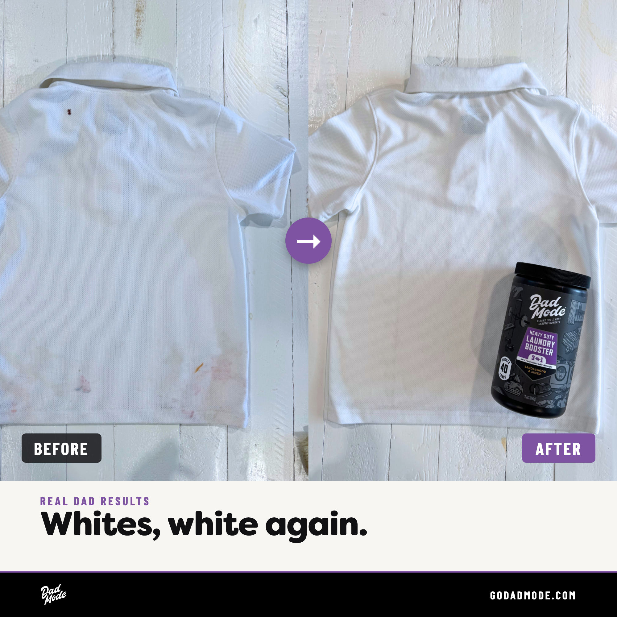 Laundry Stain Killer Bundle