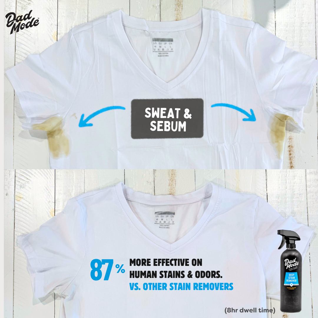 7-Enzyme Stain Remover