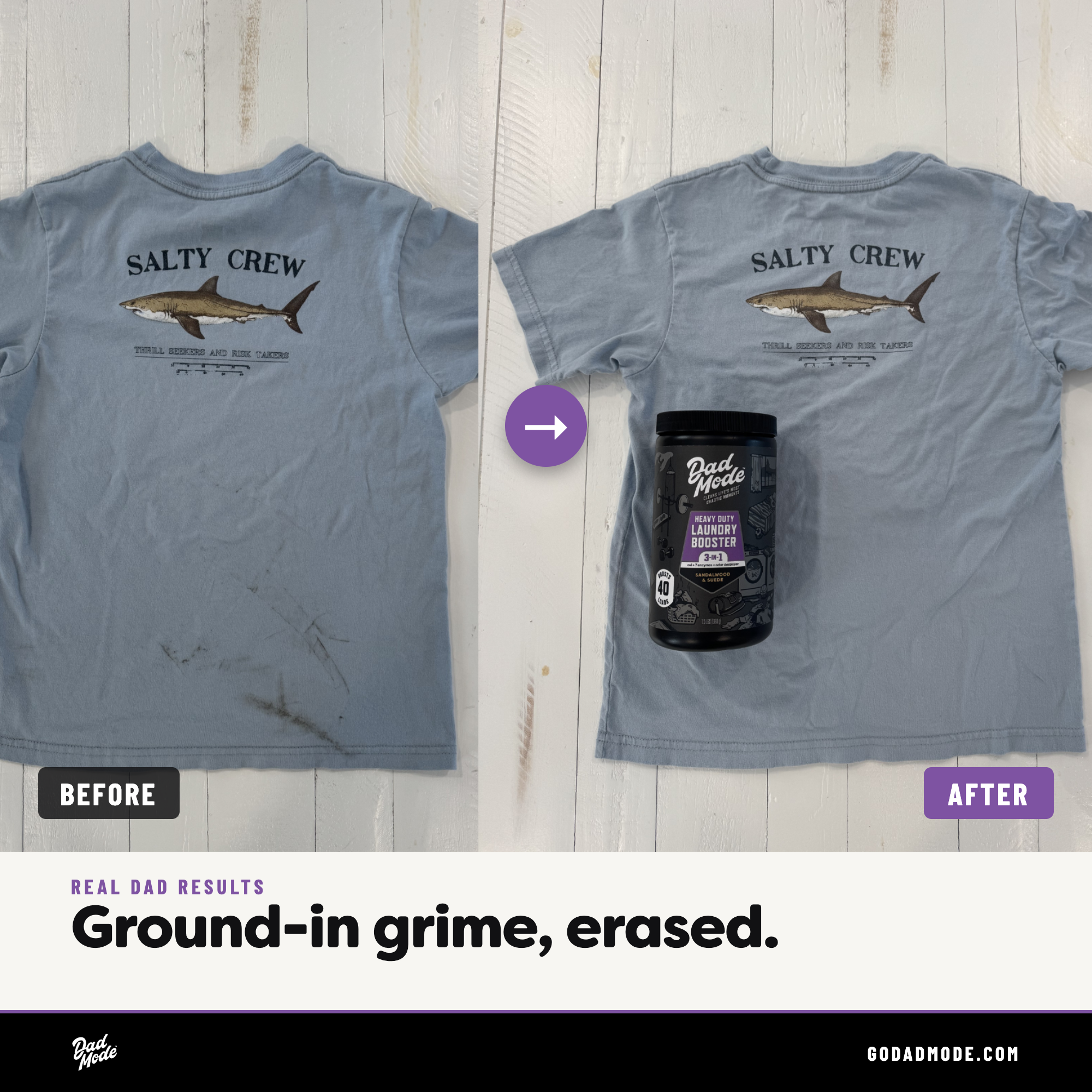 Laundry Stain Killer Bundle